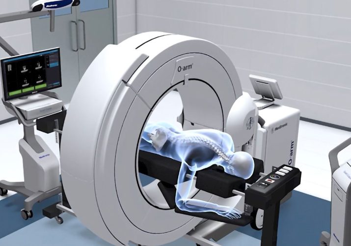 Providence Hospital Offers New O-Arm System
